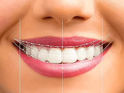 digital smile design