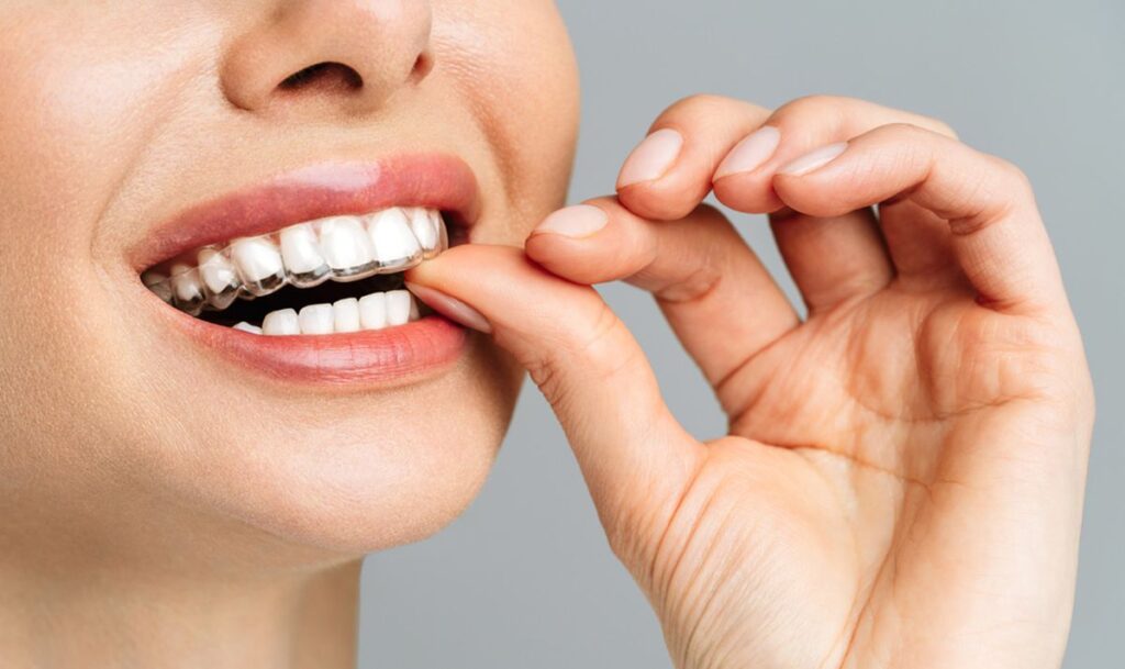 Patient wearing clear aligners for invisible teeth straightening