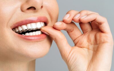 Patient wearing clear aligners for invisible teeth straightening